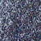 16 Pack: Black Chunky Polyester Glitter by Recollections™